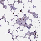 Anti-PLEKHG2 Antibody