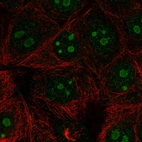 Anti-RPL22L1 Antibody