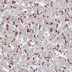 Anti-MUM1 Antibody