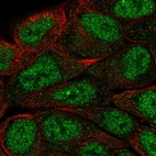 Immunofluorescent staining of human cell line RT4 shows localization to nucleoplasm.