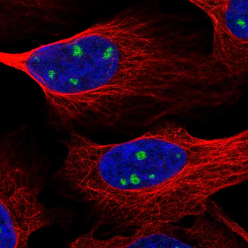 Anti-NTRK3 Antibody
