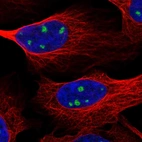 Anti-NTRK3 Antibody
