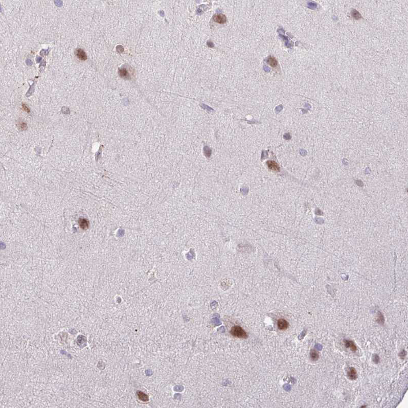 Anti-YLPM1 Antibody