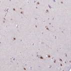 Anti-YLPM1 Antibody