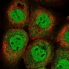 Immunofluorescent staining of human cell line A-431 shows localization to nucleoplasm & cytosol.