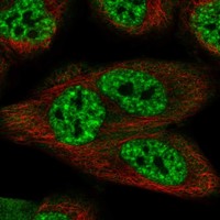 Anti-SCAPER Antibody