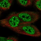 Anti-SCAPER Antibody