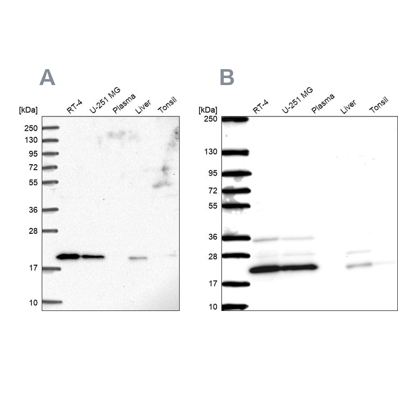 Anti-NDUFAF2 Antibody
