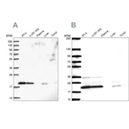 Anti-NDUFAF2 Antibody