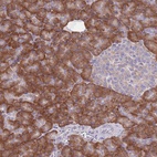 Anti-RPS10 Antibody