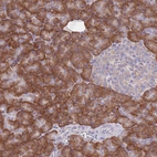 Anti-RPS10 Antibody