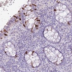Anti-BLOC1S2 Antibody