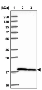 Lane 1: Marker [kDa] 250, 130, 95, 72, 55, 36, 28, 17, 10_br/_Lane 2: Human cell line RT-4_br/_Lane 3: Human cell line U-251MG sp