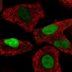 Immunofluorescent staining of human cell line A549 shows localization to nucleoplasm & cytosol.