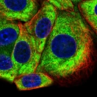 Immunofluorescent staining of human cell line MCF7 shows localization to cytosol.