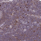 Immunohistochemical staining of human lymph node shows strong cytoplasmic positivity in a subset of non-germinal center cells.