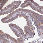 Immunohistochemical staining of human fallopian tube shows strong cytoplasmic positivity in glandular cells.