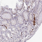 Immunohistochemical staining of human stomach shows strong cytoplasmic positivity in leukocytes.