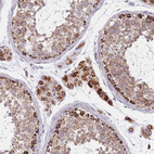 Anti-DDX49 Antibody