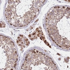 Anti-DDX49 Antibody