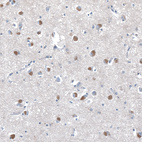 Immunohistochemical staining of human cerebral cortex shows moderate positivity in neuronal cells.