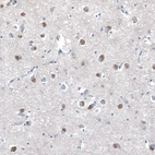 Immunohistochemical staining of human cerebral cortex shows moderate positivity in neuronal cells.