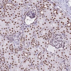 Anti-EVC2 Antibody
