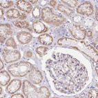 Immunohistochemical staining of human kidney shows moderate granular cytoplasmic positivity in cells in tubules.