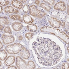 Immunohistochemical staining of human kidney shows moderate granular cytoplasmic positivity in cells in tubules.