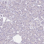 Immunohistochemical staining of human pancreas shows no positivity in exocrine glandular cells as expected.