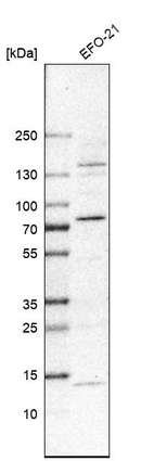 Western blot analysis in human cell line EFO-21.