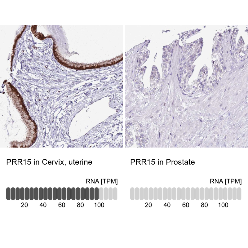 Anti-PRR15 Antibody