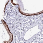 Immunohistochemical staining of human cervix, uterine shows high expression.