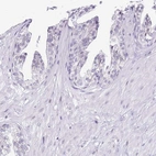 Immunohistochemical staining of human prostate shows low expression as expected.