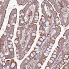 Anti-ARMCX6 Antibody