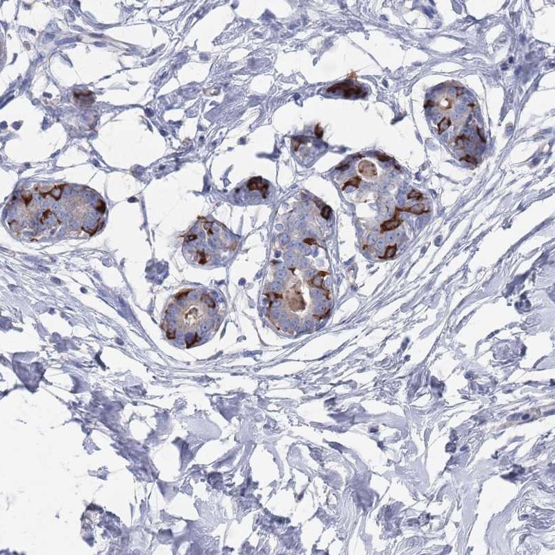 Anti-TMCO3 Antibody