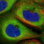 Immunofluorescent staining of human cell line A-431 shows localization to cytosol.