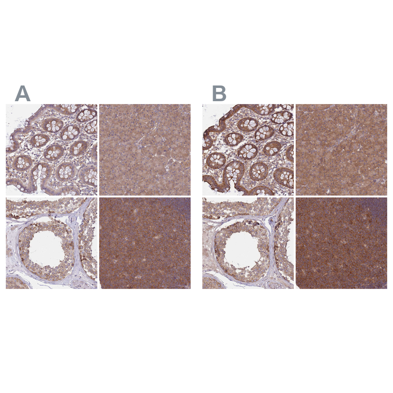 Anti-PFDN6 Antibody