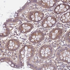 Immunohistochemical staining of human colon shows moderate cytoplasmic positivity in glandular cells.