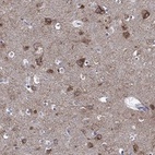 Anti-SHOC2 Antibody