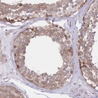 Immunohistochemical staining of human testis shows moderate cytoplasmic positivity in cells in seminiferous ducts.