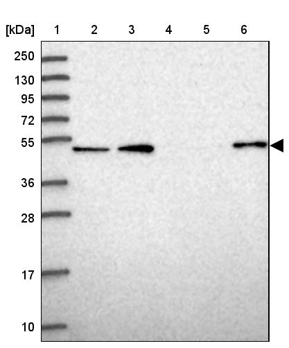 Anti-WSCD2 Antibody