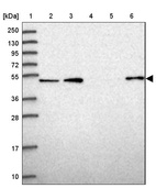 Anti-WSCD2 Antibody
