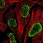 Immunofluorescent staining of human cell line U-2 OS shows localization to nucleoplasm.