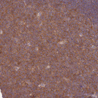 Immunohistochemical staining of human tonsil shows moderate cytoplasmic positivity in germinal center cells.