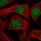 Immunofluorescent staining of human cell line U-2 OS shows localization to nucleus & nucleoli.