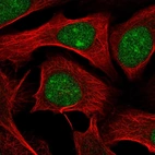 Immunofluorescent staining of human cell line U-2 OS shows localization to nucleus & nucleoli.