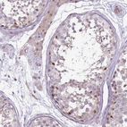 Anti-GSTO2 Antibody