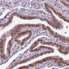 Immunohistochemical staining of human fallopian tube shows moderate to strong nuclear positivity in glandular cells.