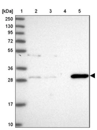 Lane 1: Marker [kDa] 250, 130, 95, 72, 55, 36, 28, 17, 10_br/_Lane 2: Human cell line RT-4_br/_Lane 3: Human cell line U-251MG sp_br/_Lane 4: Human plasma (IgG/HSA depleted)_br/_Lane 5: Human liver tissue